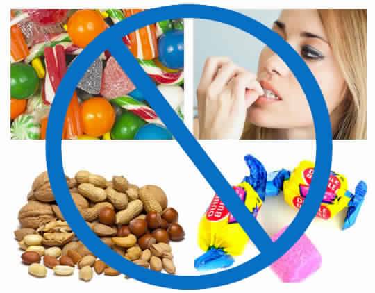 Foods To Avoid During Braces Treatment - Sabka Dentist