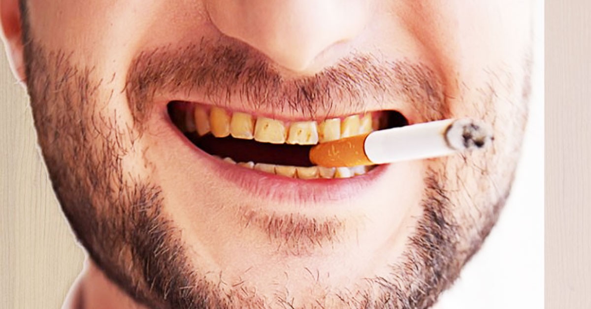 Effects Of Smoking On Teeth