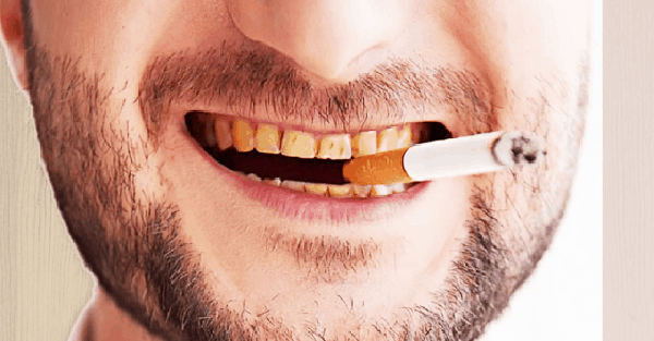 Does Nicotine Make Your Teeth Yellow?