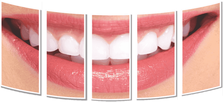 Dental Treatments in EMI