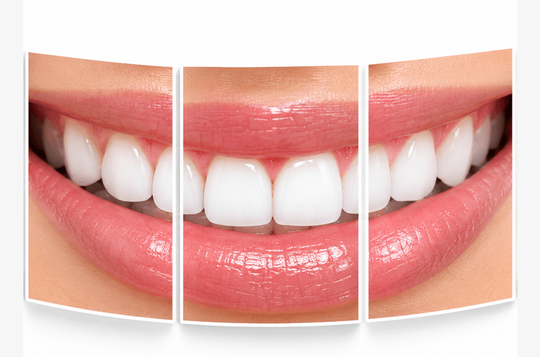 Dental-Treatments-on-EMI