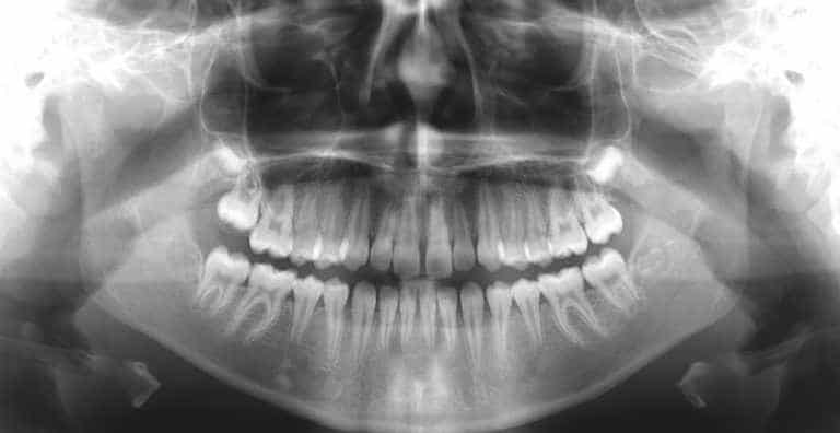 Dental Radiology Practice