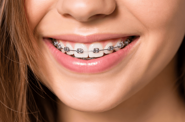 orthodontic-treatment