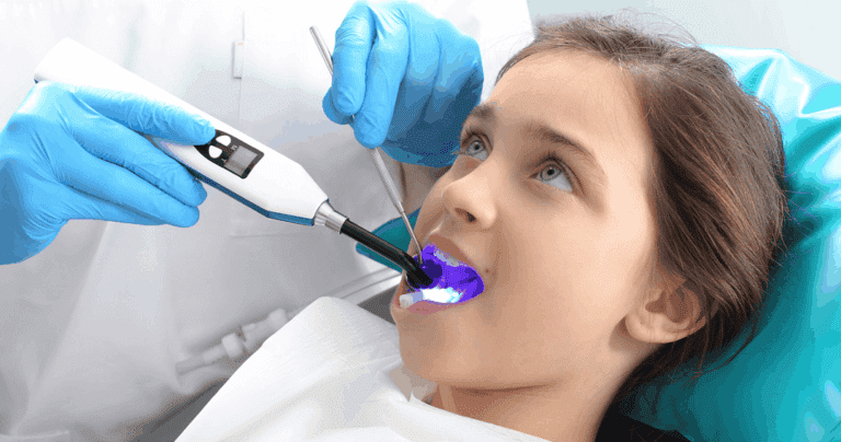 pit-fissure-sealant