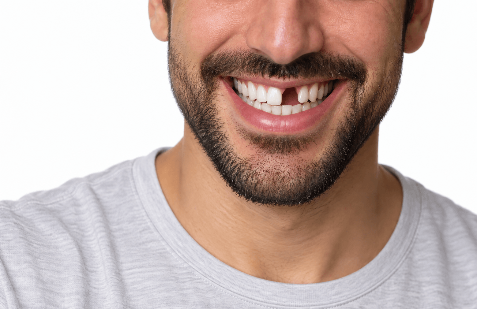 missing tooth