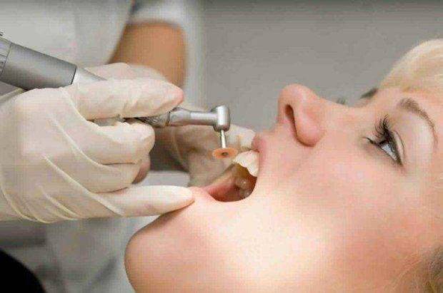 teeth cleaning and polishing