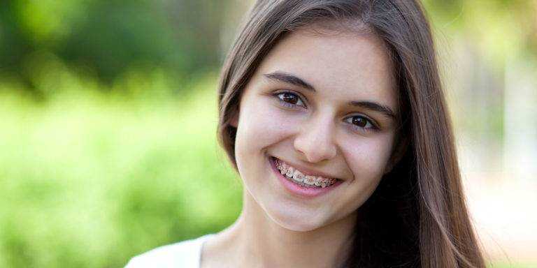 braces-treatment-in-oshiwara