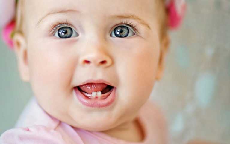 Common Teeth Problem Babies Face and its Solution
