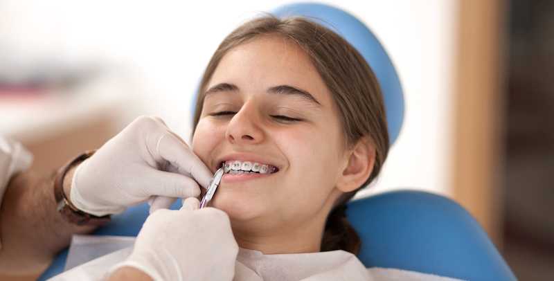 fast braces elastics