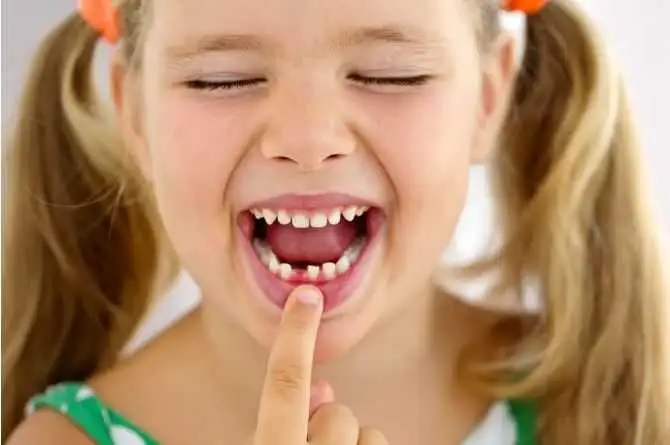 milk-teeth-1.jpg.webp