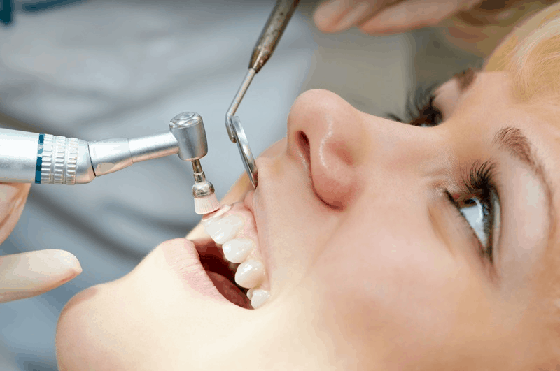 teeth cleaning