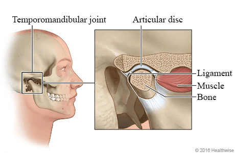 Temporomandibular disorders