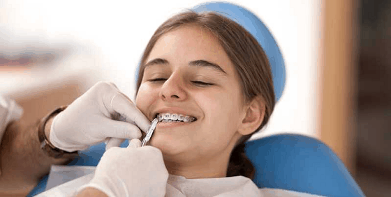 Cost of Metal Braces – Sabka Dentist – Top Dental Clinic Chain In India