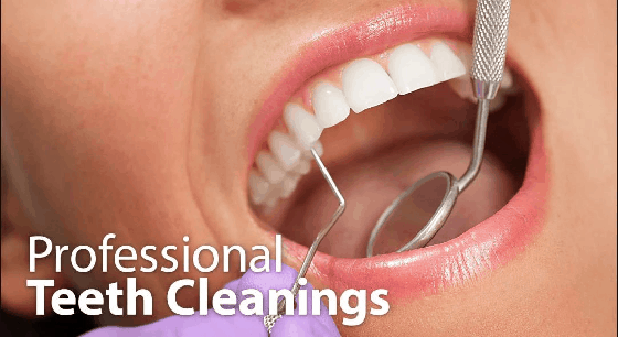 Professional teeth cleaning