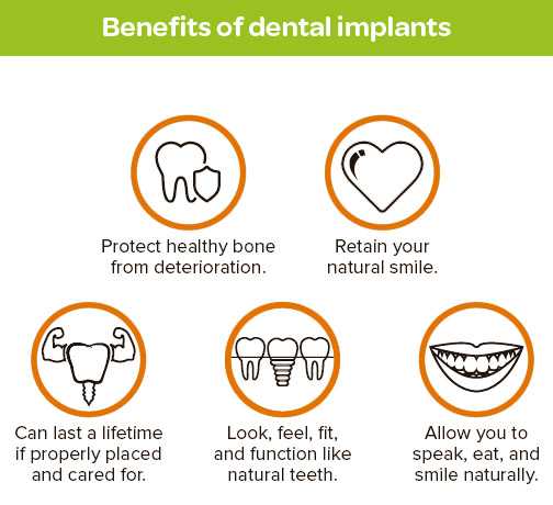 dental implants