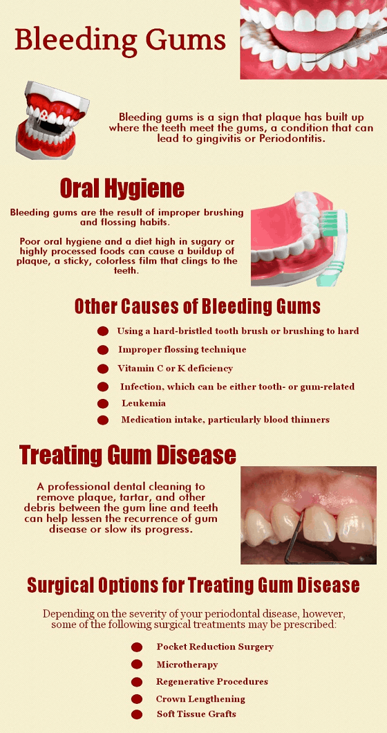 causes of bleeding gums