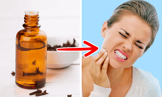 Clove Oil And Dental Health