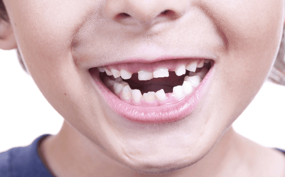 difference between milk teeth and permanent teeth