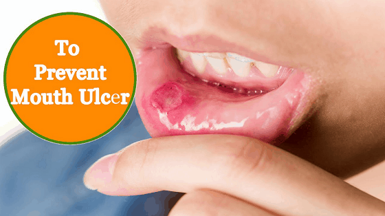 Prevent mouth ulcer