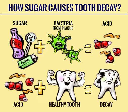 sugar causes tooth decay