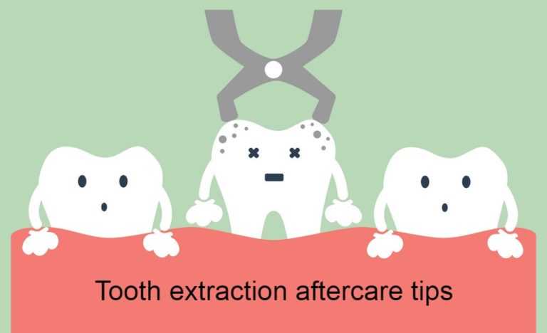 tooth-extraction-aftercare-tips