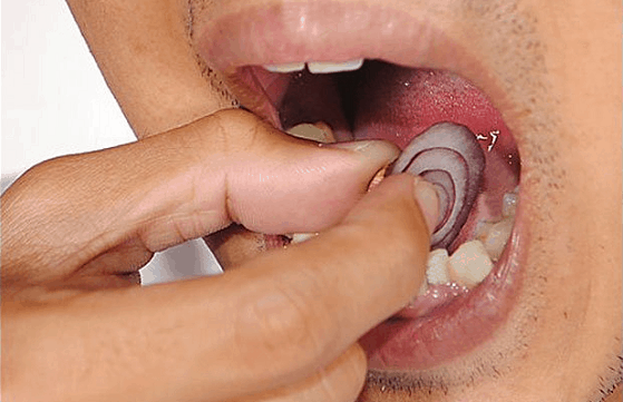 tooth infection onion remedy