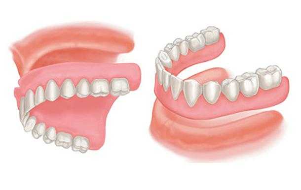 full denture