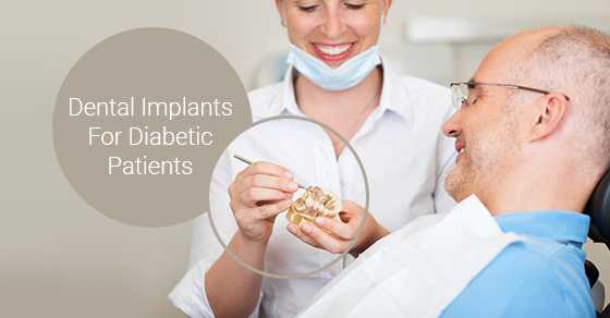 Dental-Implants-For-Diabetic-Patients