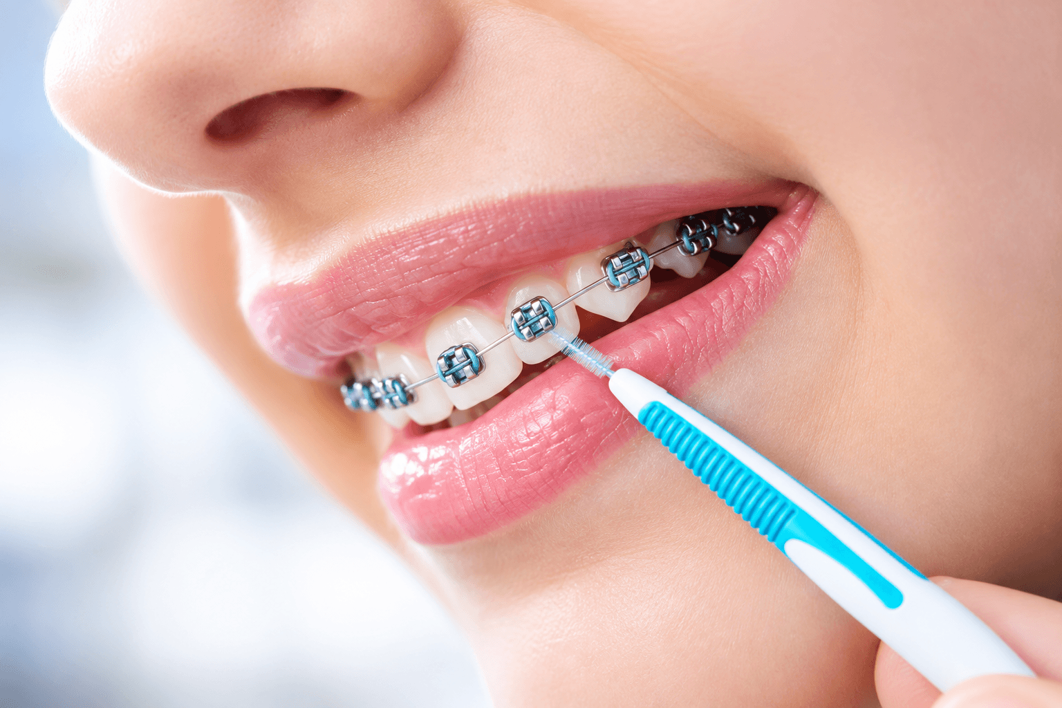 interdental flossing