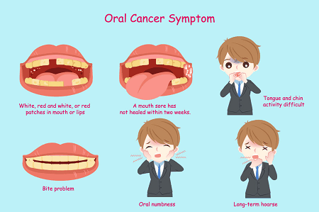 Oral Cancer Symptoms Causes Prevention Diagnose