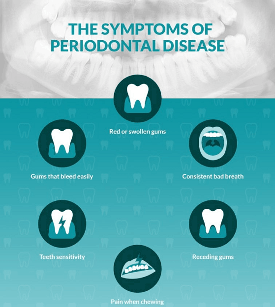 Exploring The Symptoms And Causes Of Gum Disease 6431