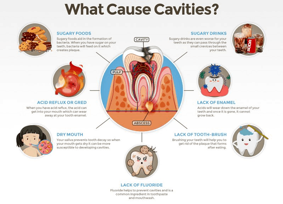 what causes tooth decay