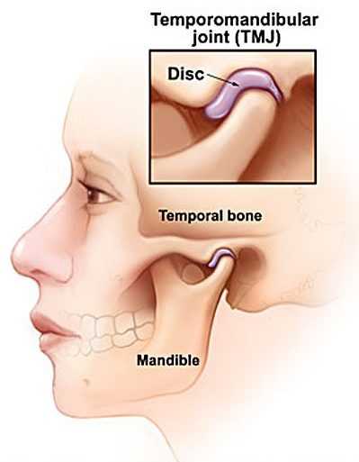 Whether TMD or trismus, jaw trouble needs attention