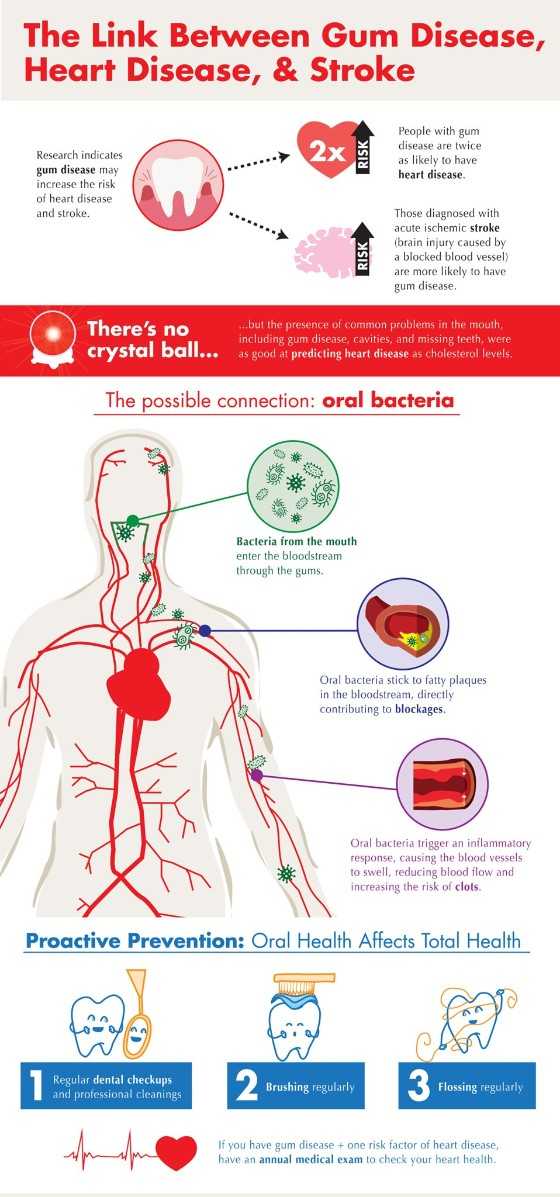 Oral health and heart disease