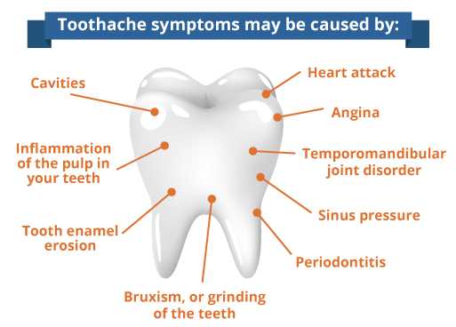 do cavities cause pain