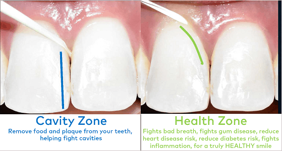 benefits of dental floss