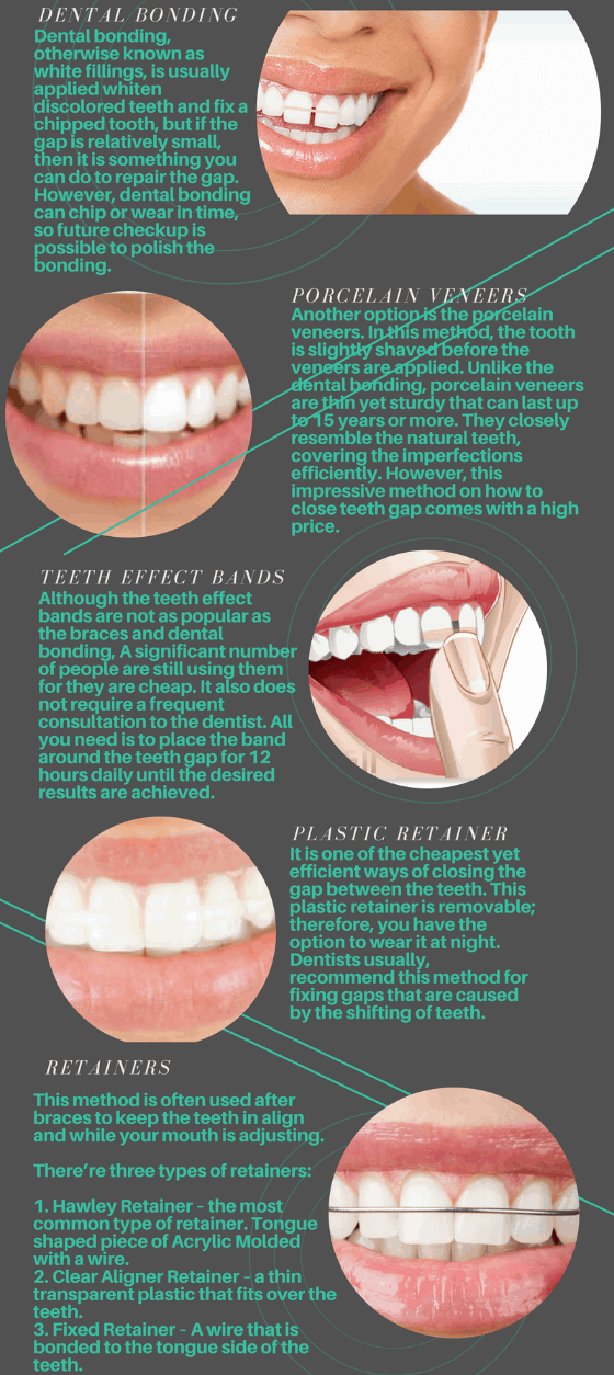 How To Fix Gap In Front Teeth Without Braces