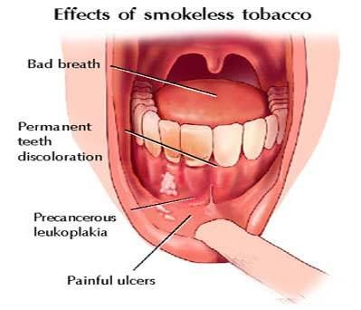 smokeless tobacco effects