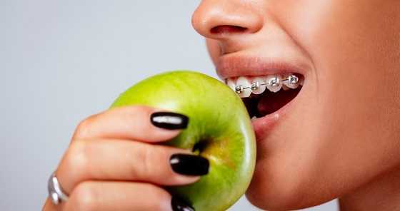 Avoid Eating With Braces