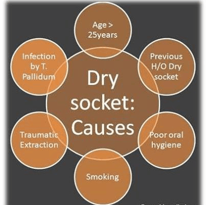 Figure 3 from Dry Socket Etiology, Diagnosis, and Clinical Treatment  Techniques