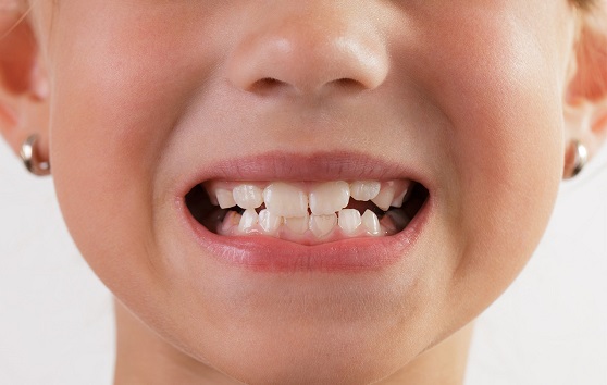 Child teeth
