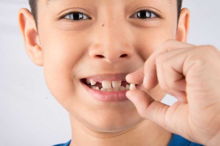Preventing-Children-from-Having-Crooked-Teeth