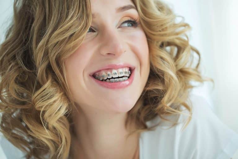 Tips-and-Tricks-for-braces-patients