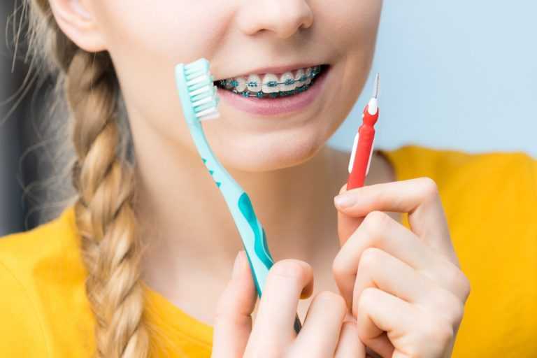 What Happens If You Have Braces And Don't Brush Your Teeth?