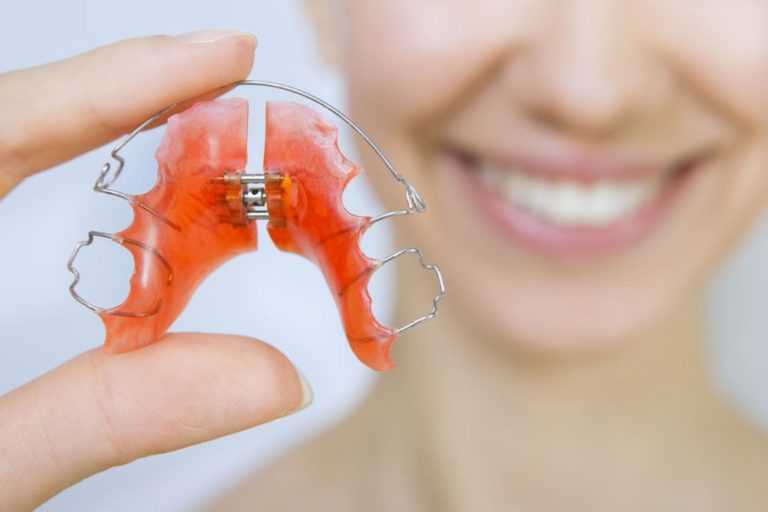 Why-you-need-to-wear-your-retainer