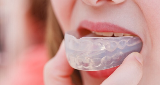 mouth-guard-for-teeth