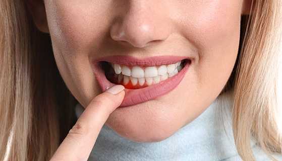 Tooth decay and gum disease