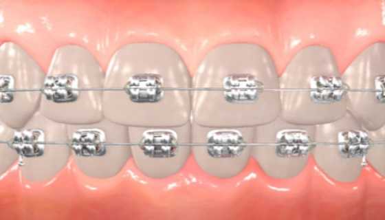 Orthodontic applications