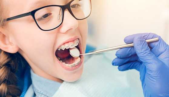 types of orthodontic-treatment