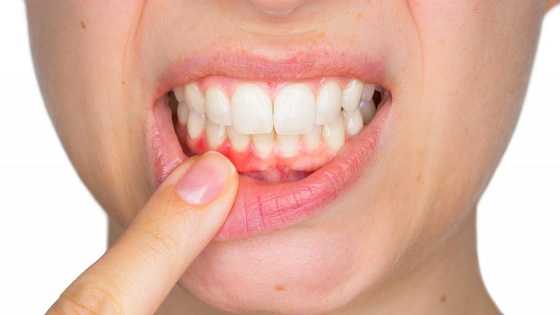 Infection in the gums